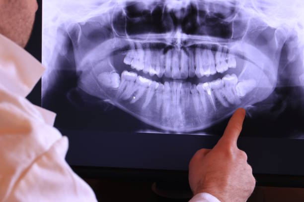 Best Knocked-Out Tooth Emergency  in Robesonia, PA